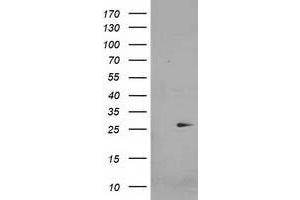 HEK293T cells were transfected with the pCMV6-ENTRY control (Left lane) or pCMV6-ENTRY CDKN3 (Right lane) cDNA for 48 hrs and lysed. (CDKN3 antibody)