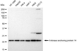 Western blotting analysis using A-kinase anchoring protein 14 antibody (ABIN7797433).