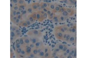 Figure. (alpha KGDHC antibody  (AA 256-582))