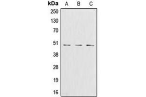 Western blot analysis of Glutamine Synthetase expression in Jurkat (A), HeLa (B), HT29 (C) whole cell lysates. (GLN1 antibody  (Center))