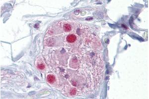 Immunohistochemistry with Colon, submucosal plexus tissue at an antibody concentration of 5µg/ml using anti-NR3C1 antibody (ARP45593_P050)