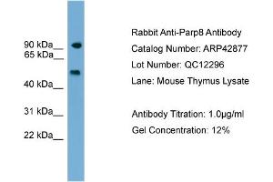 WB Suggested Anti-Parp8 Antibody Titration:  0. (PARP8 antibody  (C-Term))