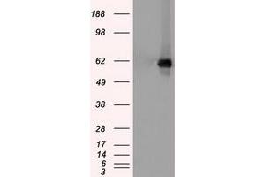 Western Blotting (WB) image for anti-Checkpoint Kinase 2 (CHEK2) antibody (ABIN1497495) (CHEK2 antibody)
