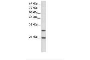 Image no. 2 for anti-Msh Momeobox 2 (Msx2) (N-Term) antibody (ABIN202139) (Msx2/Hox8 antibody  (N-Term))
