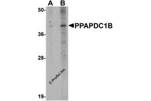 Western Blotting (WB) image for anti-Phosphatidic Acid Phosphatase Type 2 Domain Containing 1B (PPAPDC1B) (N-Term) antibody (ABIN1031523)