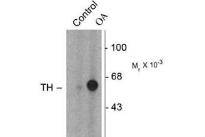 Image no. 2 for anti-Tyrosine Hydroxylase (TH) (pSer31) antibody (ABIN227933) (Tyrosine Hydroxylase antibody  (pSer31))