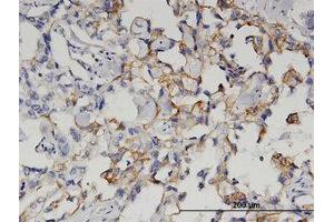 Image no. 1 for anti-Glutaminyl-Peptide Cyclotransferase (QPCT) (AA 262-360) antibody (ABIN599543) (QPCT antibody  (AA 262-360))