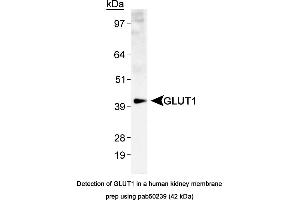 Image no. 2 for anti-Solute Carrier Family 2 (Facilitated Glucose Transporter), Member 1 (SLC2A1) (AA 1-100), (N-Term) antibody (ABIN363548) (GLUT1 antibody  (N-Term))