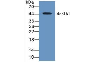 Detection of Recombinant ACAT2, Human using Polyclonal Antibody to Acetyl Coenzyme A Acetyltransferase 2 (ACAT2) (ACAT2 antibody  (AA 1-397))