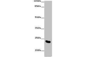 Western blot All lanes: AICDA antibody at 10 μg/mL + Mouse liver tissue Secondary Goat polyclonal to rabbit IgG at 1/10000 dilution Predicted band size: 24, 23 kDa Observed band size: 24 kDa (AICDA antibody  (AA 1-60))