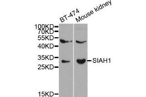 Western blot analysis of extracts of various cell lines, using SIAH1 antibody. (SIAH1 antibody  (AA 1-313))