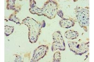 Immunohistochemistry of paraffin-embedded human placenta tissue using ABIN7150963 at dilution of 1:100 (PIAS1 antibody  (AA 422-651))