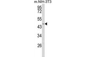 Western Blotting (WB) image for anti-WD Repeat, Sterile alpha Motif and U-Box Domain Containing 1 (WDSUB1) antibody (ABIN3003923)