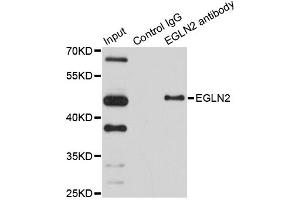 Immunoprecipitation analysis of 150 μg extracts of HeLa cells using 3 μg EGLN2 antibody (ABIN5971259). (PHD1 antibody)