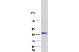 Validation with Western Blot