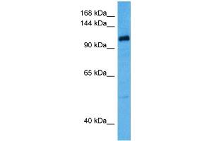 Host:  Rabbit  Target Name:  KCNQ5  Sample Tissue:  Human OVCAR-3 Whole Cell lysates  Antibody Dilution:  1ug/ml (KCNQ5 antibody  (C-Term))