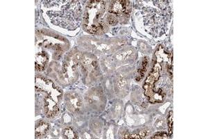 Immunohistochemical staining of human kidney with HEATR6 polyclonal antibody  shows strong cytoplasmic positivity in a subset of tubules.