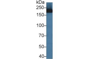 Detection of CD11b in Rat Bone marrow lysate using Polyclonal Antibody to Integrin Alpha M (CD11b) (CD11b antibody  (AA 31-160))