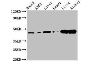 Western Blot Positive WB detected in: HepG2 whole cell lysate, K562 whole cell lysate, Rat liver tissue, Mouse heart tissue, Mouse liver tissue Mouse kindey tissue All lanes: ACAT1 antibody at 3 μg/mL Secondary Goat polyclonal to rabbit IgG at 1/50000 dilution Predicted band size: 46, 18 kDa Observed band size: 46 kDa (ACAT1 antibody  (AA 76-106))