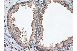 Immunohistochemical staining of paraffin-embedded Human pancreas tissue using anti-PFN1 mouse monoclonal antibody. (PFN1 antibody)