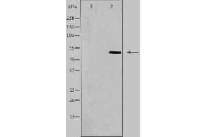Western blot analysis of extracts from K562 cells, using TRIP4 antibody.