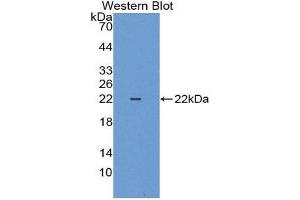 Western Blotting (WB) image for anti-Keratin 18 (KRT18) (AA 1-159) antibody (ABIN3207040) (Cytokeratin 18 antibody  (AA 1-159))