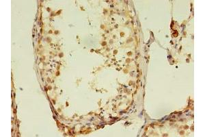 Immunohistochemistry of paraffin-embedded human testis tissue using ABIN7168075 at dilution of 1:100 (RTKN2 antibody  (AA 1-163))