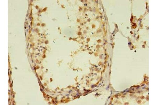 RTKN2 antibody  (AA 1-163)