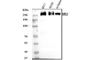 Western blot analysis of GP210/NUP210 using anti-GP210/NUP210 antibody (ABIN7600707).