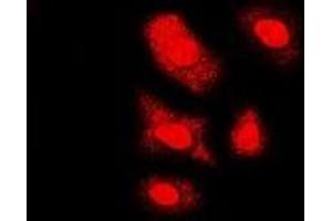Immunofluorescent analysis of FKBP6 staining in U2OS cells.