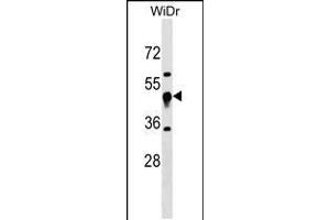 Western blot analysis in WiDr cell line lysates (35ug/lane). (UQCRC1 antibody  (N-Term))