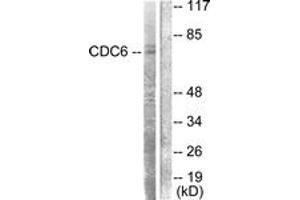 Western blot analysis of extracts from HT-29 cells, using CDC6 (Ab-54) Antibody.