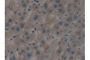 Detection of tPA in Human Liver Tissue using Polyclonal Antibody to Tissue Plasminogen Activator (tPA) (PLAT antibody)
