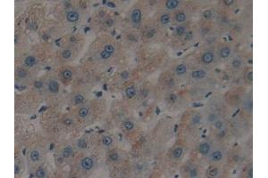 Detection of tPA in Human Liver Tissue using Polyclonal Antibody to Tissue Plasminogen Activator (tPA) (PLAT antibody)