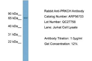 Western Blotting (WB) image for anti-Protein Kinase C, eta (PRKCH) (N-Term) antibody (ABIN2786852) (PKC eta antibody  (N-Term))
