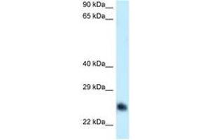 Image no. 1 for anti-Calcium Binding tyrosine-(Y)-phosphorylation Regulated (CABYR) (AA 93-142) antibody (ABIN6747985) (CABYR antibody  (AA 93-142))