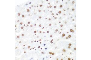 Immunohistochemistry of paraffin-embedded mouse liver using AGO2 antibody at dilution of 1:100 (40x lens). (AGO2 antibody)