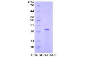 SDS-PAGE (SDS) image for Lysophosphatidylcholine Acyltransferase 3 (LPCAT3) (AA 122-233) protein (His tag) (ABIN1170895)