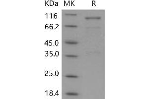 SEMA3A Protein (Fc Tag)