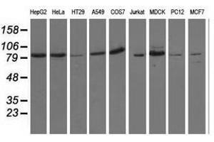 Image no. 2 for anti-Oxysterol Binding Protein-Like 11 (OSBPL11) antibody (ABIN1499923) (OSBPL11 antibody)