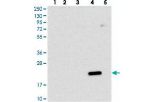 Western blot analysis of Lane 1: RT-4, Lane 2: U-251 MG, Lane 3: Human Plasma, Lane 4: Liver, Lane 5: Tonsil with DCTN5 polyclonal antibody .