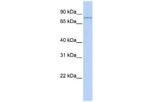 WB Suggested Anti-HDAC9 Antibody Titration:  0. (HDAC9 antibody  (Middle Region))