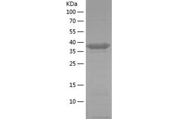 PFKP Protein (AA 436-784) (His tag)