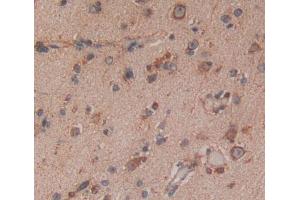 Immunohistochemistry (IHC) image for anti-Interferon Regulatory Factor 8 (IRF8) (AA 128-426) antibody (ABIN7444418)