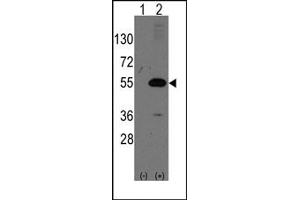 Image no. 1 for anti-Nuclear Receptor Subfamily 0, Group B, Member 1 (NR0B1) (N-Term) antibody (ABIN357833) (NR0B1 antibody  (N-Term))