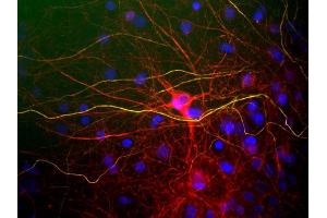 View of mixed neuron/glial cultures stained with NF-L / NEFL antibody (red) and rabbit antibody to phosphorylated NF-H (green). (NEFL antibody)
