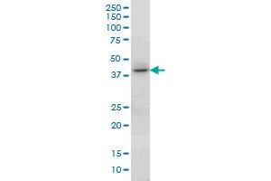 HOXC13 monoclonal antibody (M01), clone 10D4 Western Blot analysis of HOXC13 expression in A-549 .