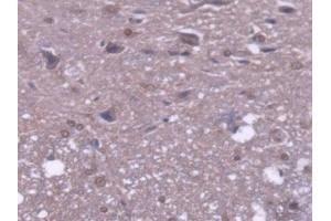 DAB staining on IHC-P; Samples: Rat Spinal cord Tissue (MTUS1 antibody  (AA 1-196))
