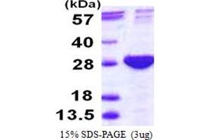 SDS-PAGE (SDS) image for Proteasome (Prosome, Macropain) Subunit, beta Type, 4 (PSMB4) (AA 46-264) protein (His tag) (ABIN667984) (PSMB4 Protein (AA 46-264) (His tag))