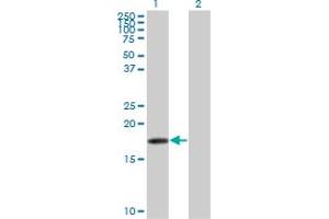 Western Blot analysis of SNCB expression in transfected 293T cell line by SNCB monoclonal antibody (M07), clone 3H4. (beta Synuclein antibody  (AA 1-134))